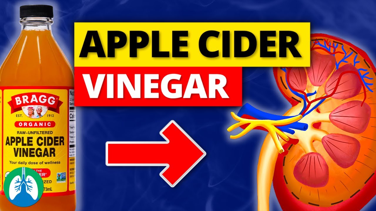 The Science Behind Apple Cider Vinegar and Kidney Stone Prevention