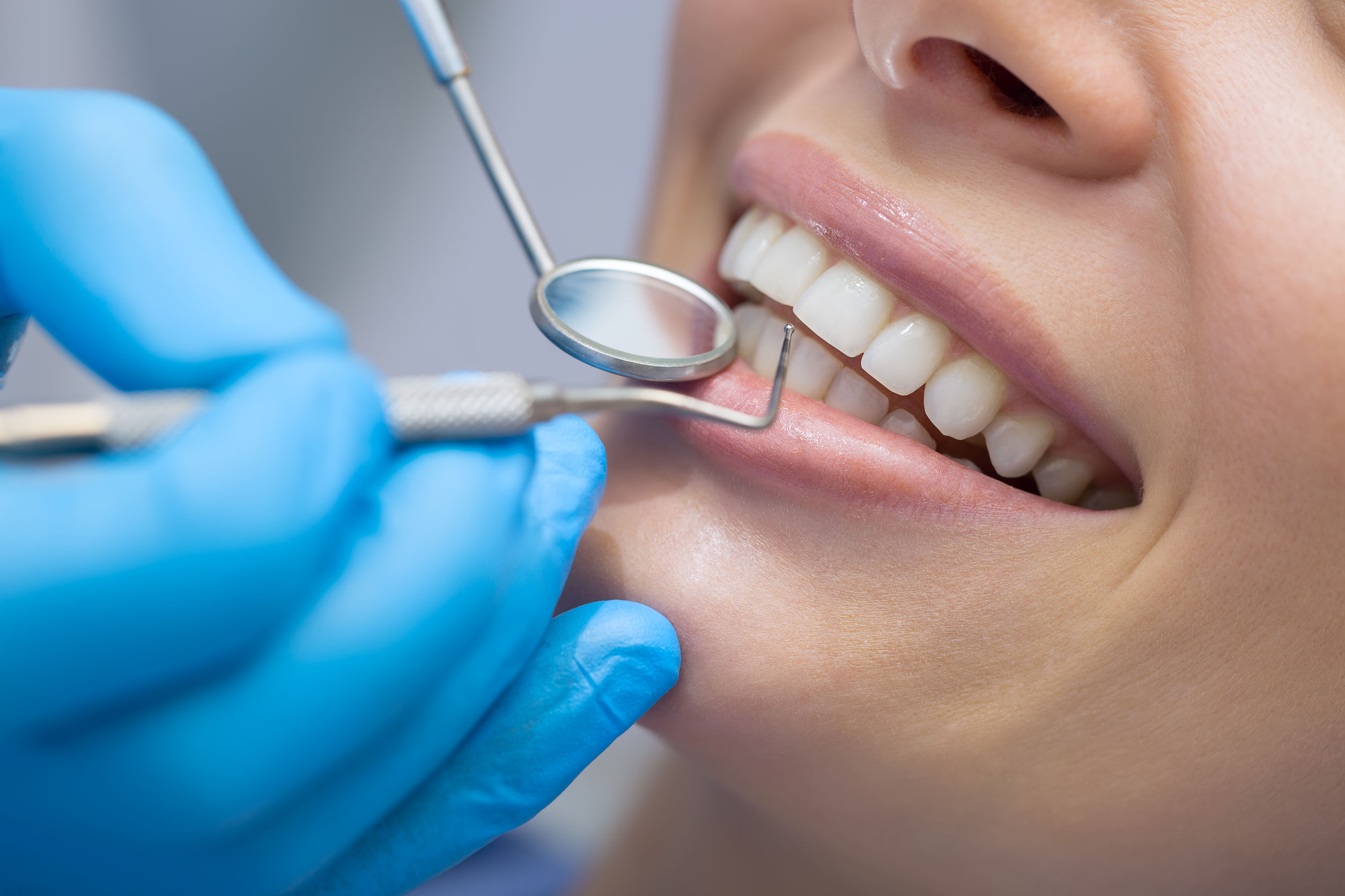 Tips to Have Reasonable Dental Consideration